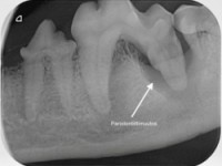 Hampaiden röntgenkuvaus